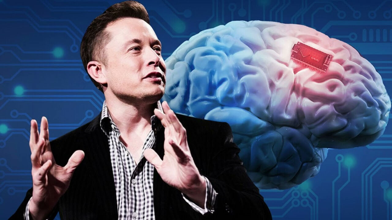 Elon Musk tarih verdi! 2026'ya kadar 1000'den fazla insana çip takılacak Elon Musk tarih verdi! 2026'ya kadar 1000'den fazla insana çip takılacak - 2. Resim
