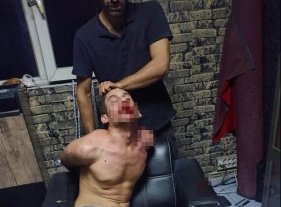 Antalya'ya çalışmak için giden Şanlıurfalı Vedat Kurt'a elektrik verilerek, dişi kırılarak ve böcek yedirilerek işkence yapıldı - 1. Resim