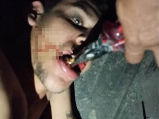 Antalya'ya çalışmak için giden Şanlıurfalı Vedat Kurt'a elektrik verilerek, dişi kırılarak ve böcek yedirilerek işkence yapıldı - 3. Resim