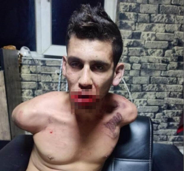 Antalya'ya çalışmak için giden Şanlıurfalı Vedat Kurt'a elektrik verilerek, dişi kırılarak ve böcek yedirilerek işkence yapıldı - 5. Resim