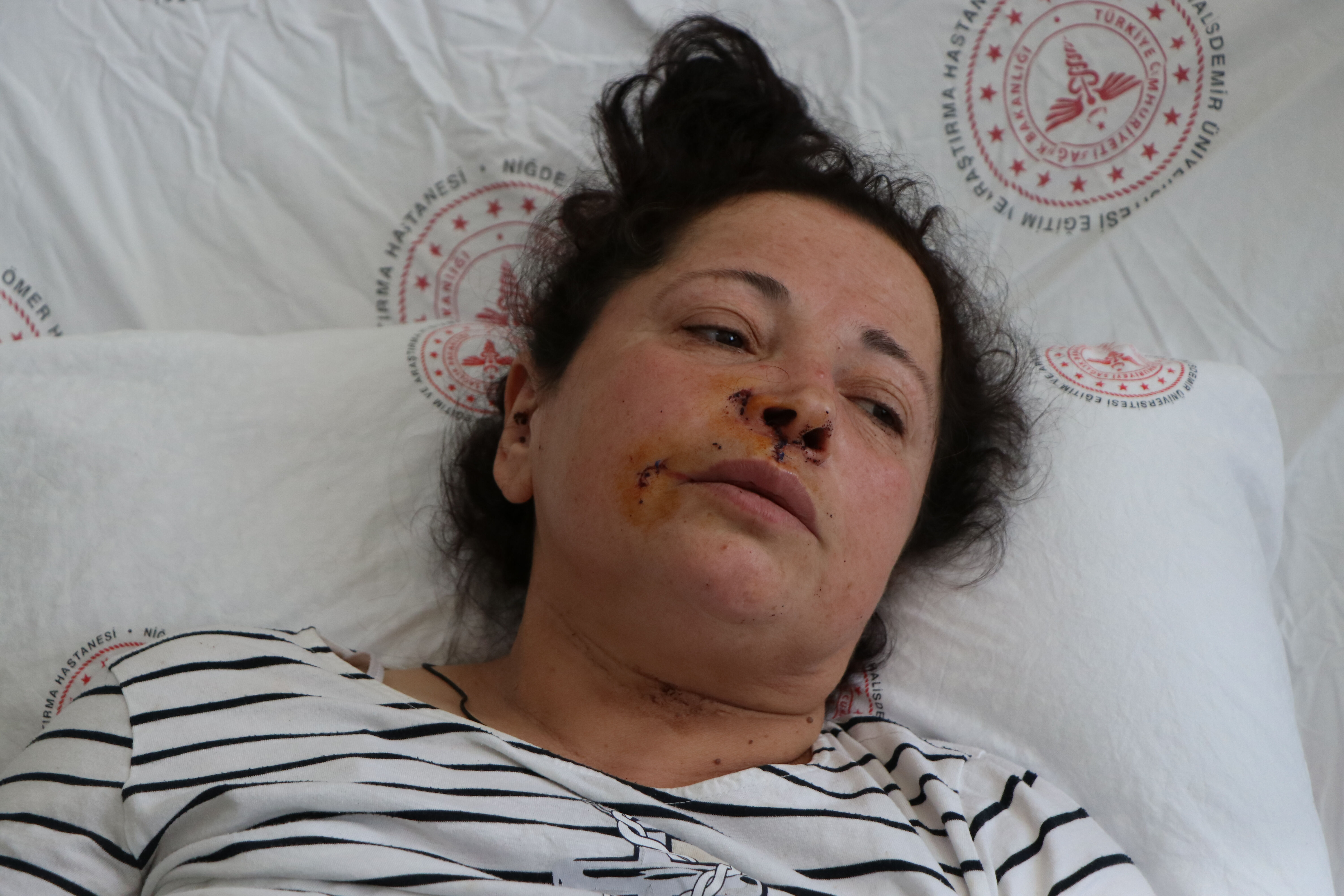 Niğde'de başıboş köpekler kadına saldırdı! Köpeklerin sahibi gözaltına alındı Niğde'de başıboş köpekler kadına saldırdı - 1. Resim