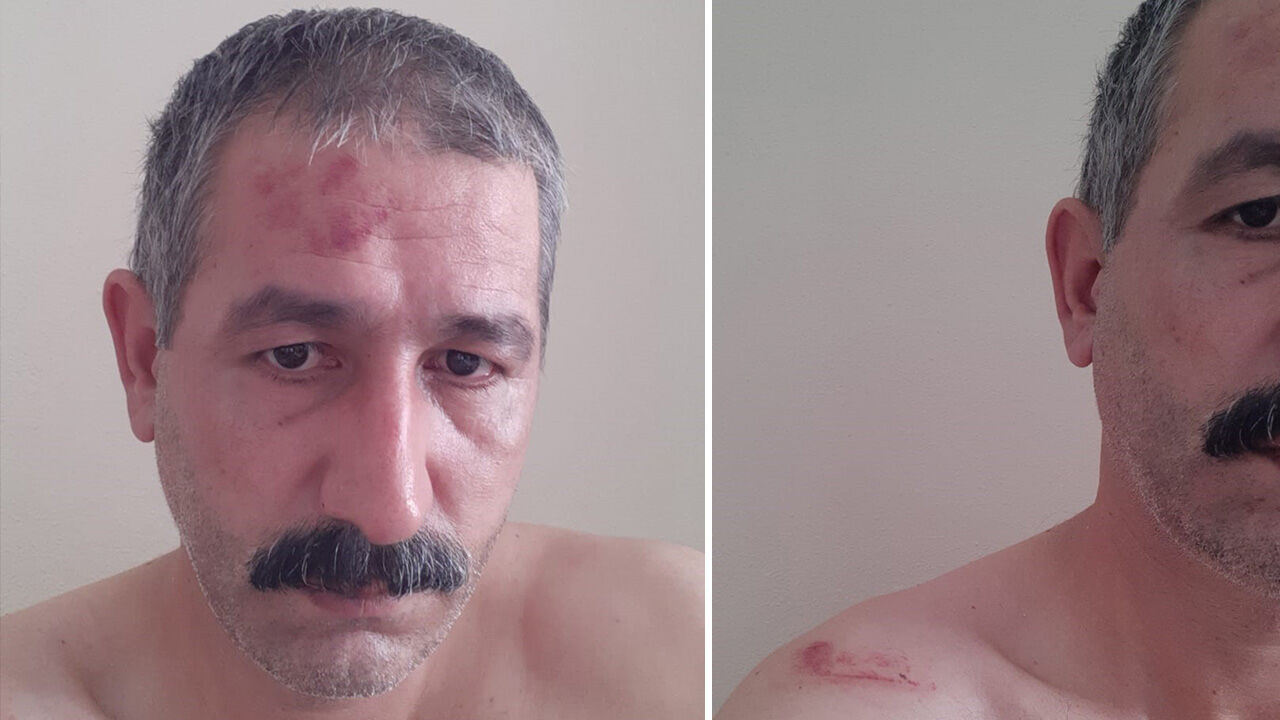 'Çöp uyarısı' başını yaktı! 15 kişi birden saldırdı, cebindeki parayı da kavgada kaptırdı - 1. Resim