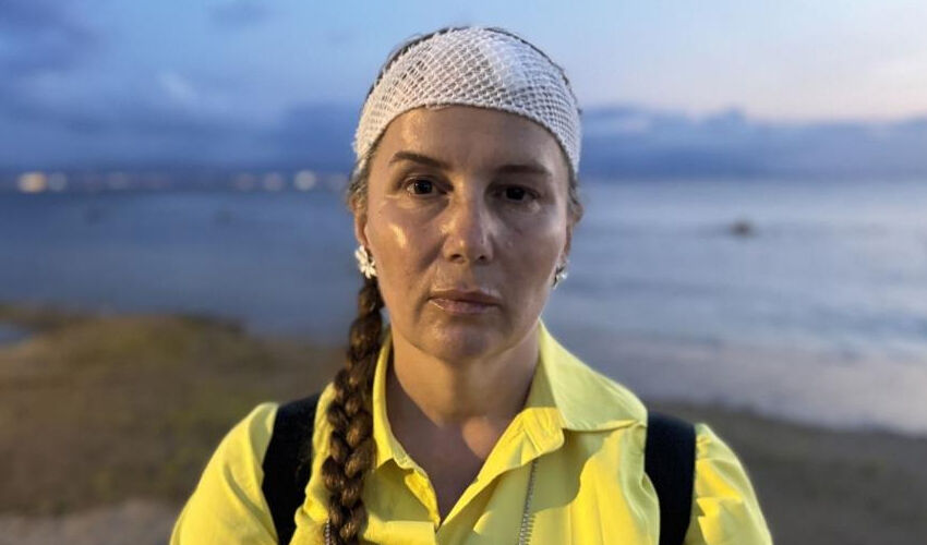 Denizde yüzerken jet ski çarptı! Başına gelenler korkunç: Etrafım kan içindeydi - 2. Resim