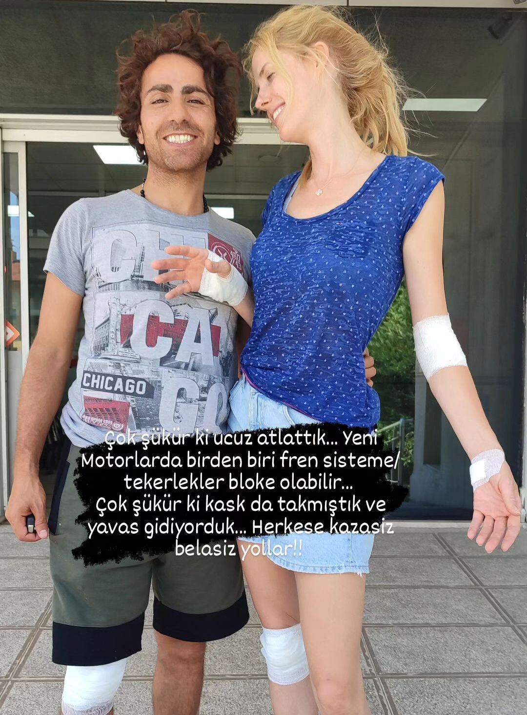 Wilma Elles motosiklet kazası geçirdi! Yaralı halini paylaşıp sağlık durumunu açıkladı - 1. Resim