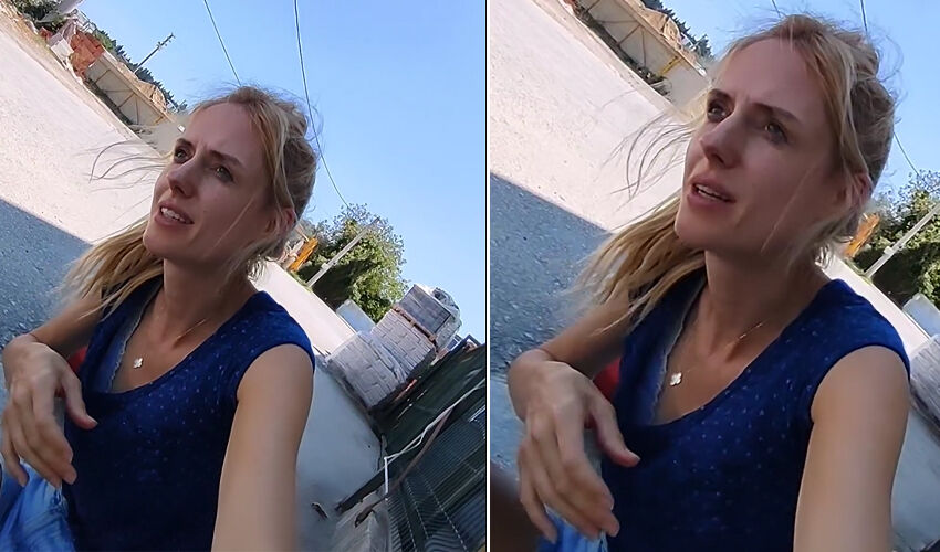 Wilma Elles motosiklet kazası geçirdi! Yaralı halini paylaşıp sağlık durumunu açıkladı - 2. Resim