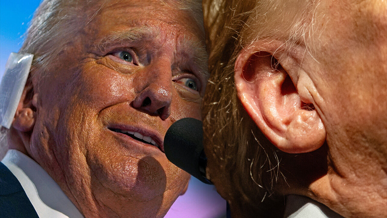 Yara ya da dikiş izleri nerede? Trump bandajı çıkardı, komplo teorilerini ortaya atıldı Yara ya da dikiş izleri nerede? Trump bandajı çıkardı, komplo teorilerini ortaya atıldı - 2. Resim