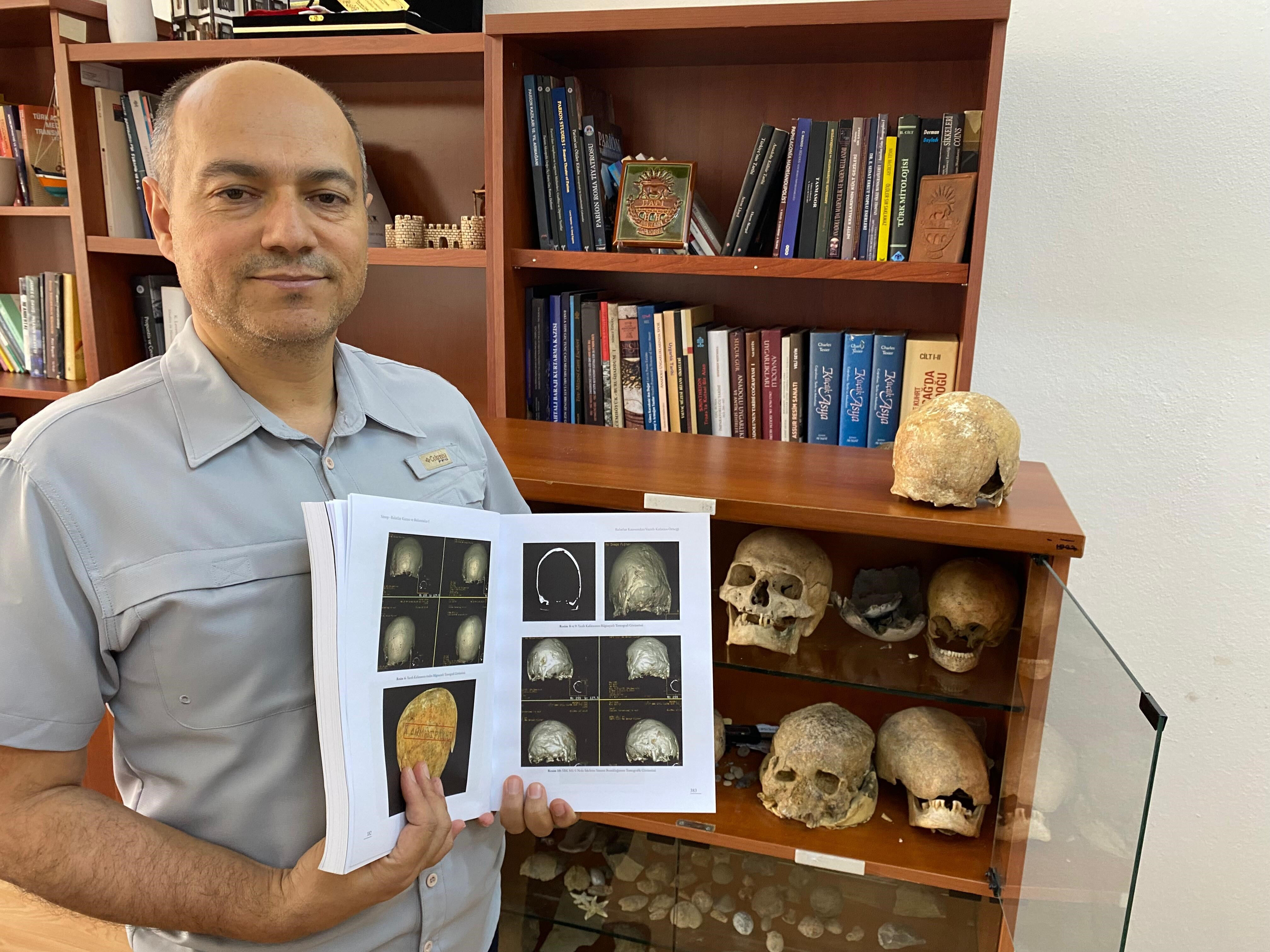 Türkiye'de böylesi görülmedi! Din adamına ait kafatası bulundu Türkiye'de böylesi görülmedi! Din adamına ait kafatası bulundu - 5. Resim