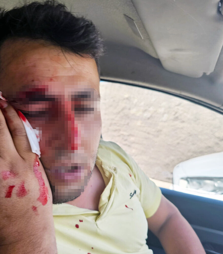 Kaçak elektrik kontrolü yapan ekibe saldırı! Personelin alnına 7 dikiş atıldı - 1. Resim