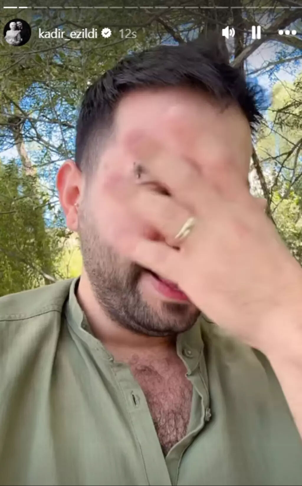 Kadir Ezildi soluğu Erzurum'da aldı! Nişanlısının tepkisi olay oldu - 2. Resim