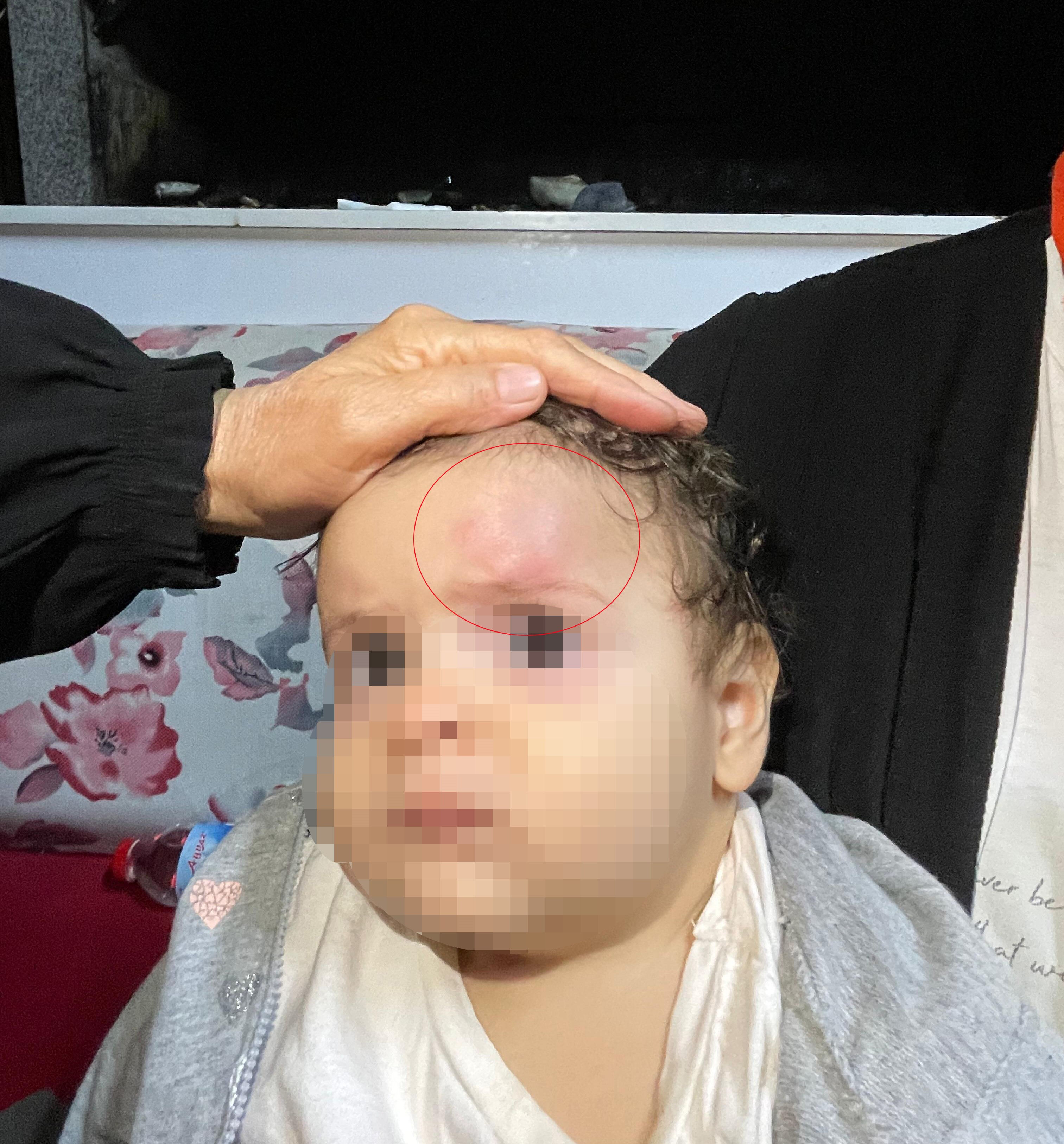 Savcı ve ailesine restoranda saldırı! 9 aylık bebekleri darbe aldı, gözaltılar var Savcı ve ailesine restoranda saldırı! 9 aylık bebekleri darbe aldı, çok sayıda gözaltı var - 4. Resim