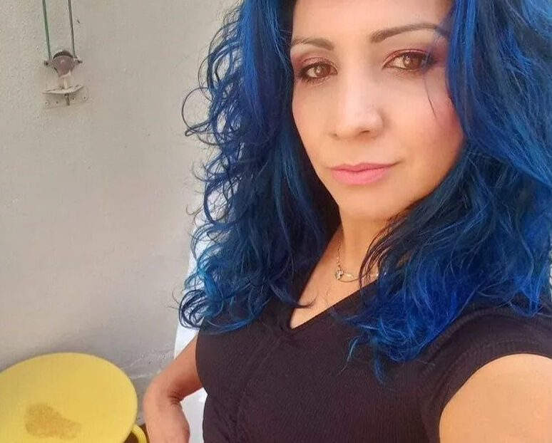 Estetik için Türkiye'ye gelen İspanyol kadın, ameliyattan 1 gün sonra öldü - 1. Resim