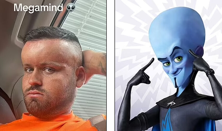 Her şey küçük bir kızarıklıkla başladı, kafası balon gibi şişti! ‘Kız arkadaşım bana bakamıyordu’ - 2. Resim