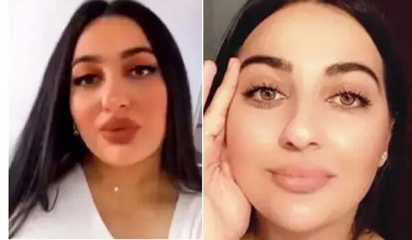 Estetik operasyonunda hayatını kaybeden Manolya Oktay'ın ölüm nedeni belli oldu! Estetik operasyonunda hayatını kaybeden Manolya Oktay'ın ölüm nedeni belli oldu! - 1. Resim