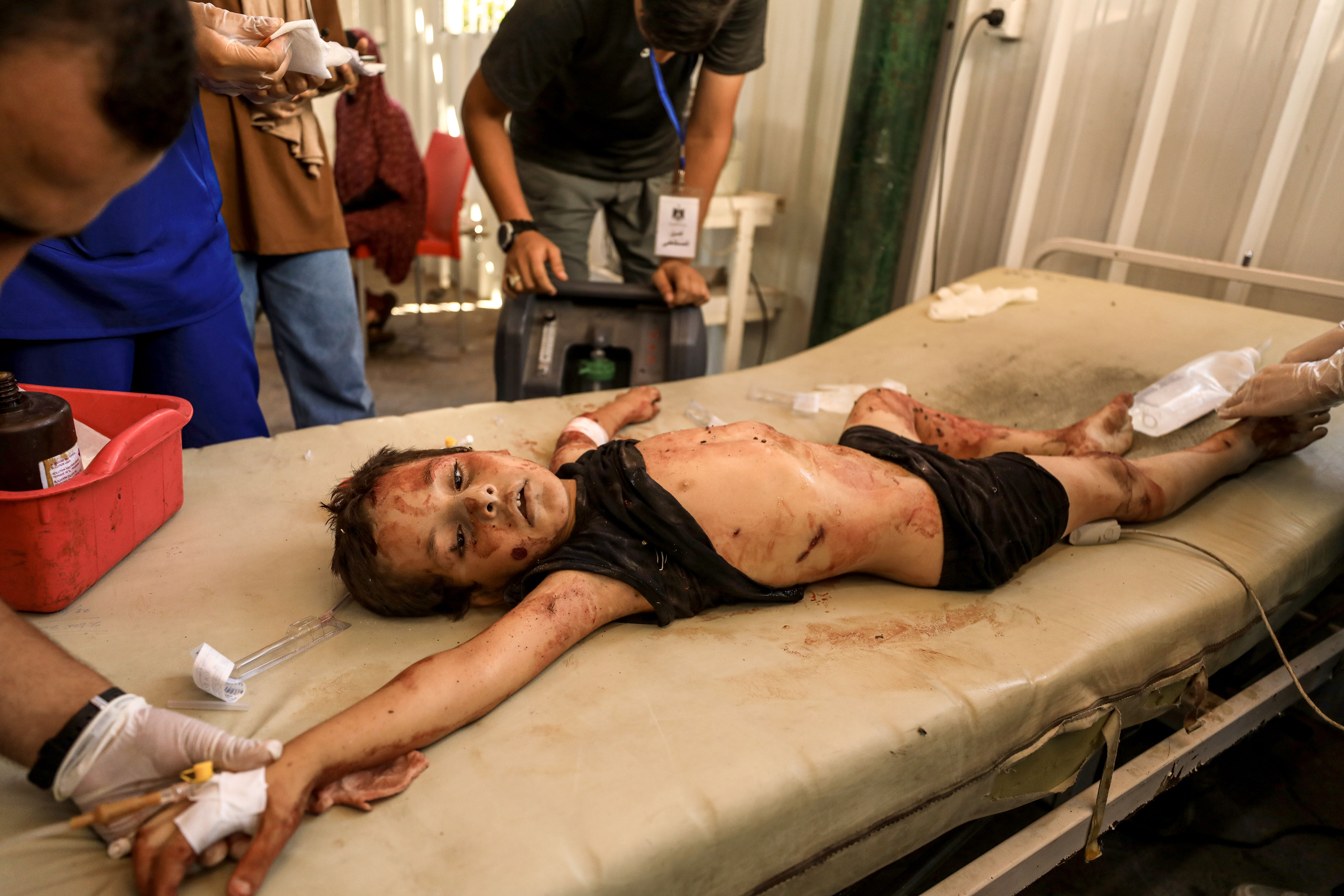 Yine çocukları hedef aldı! Çok sayıda yaralı var - 2. Resim