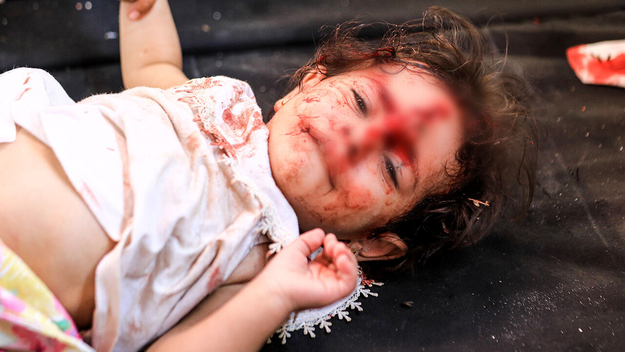 Yine çocukları hedef aldı! Çok sayıda yaralı var - 1. Resim