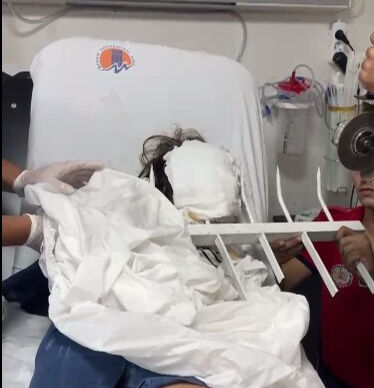 Mersin'de 7 yaşındaki çocuğun çenesine korkuluk demiri saplandı - 2. Resim