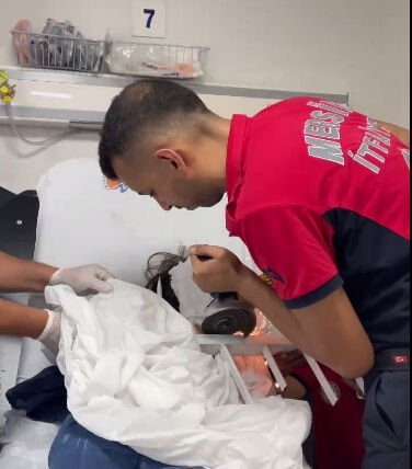 Mersin'de 7 yaşındaki çocuğun çenesine korkuluk demiri saplandı - 1. Resim