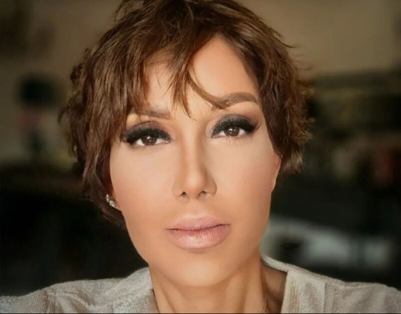 Serap Paköz’den estetik çıkışı: ‘Yaptırmadım’ diyenlere gülüyorum - 2. Resim