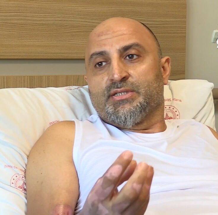 Mangal jeli hayatını kararttı! Vücudunun üçte biri yandı - 1. Resim