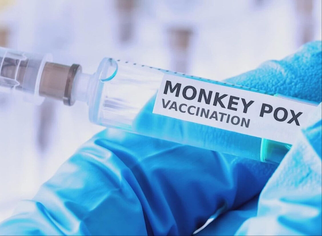 Maymun çiçeği kabusu sürüyor! Bir ülkede daha tespit edildi - 1. Resim