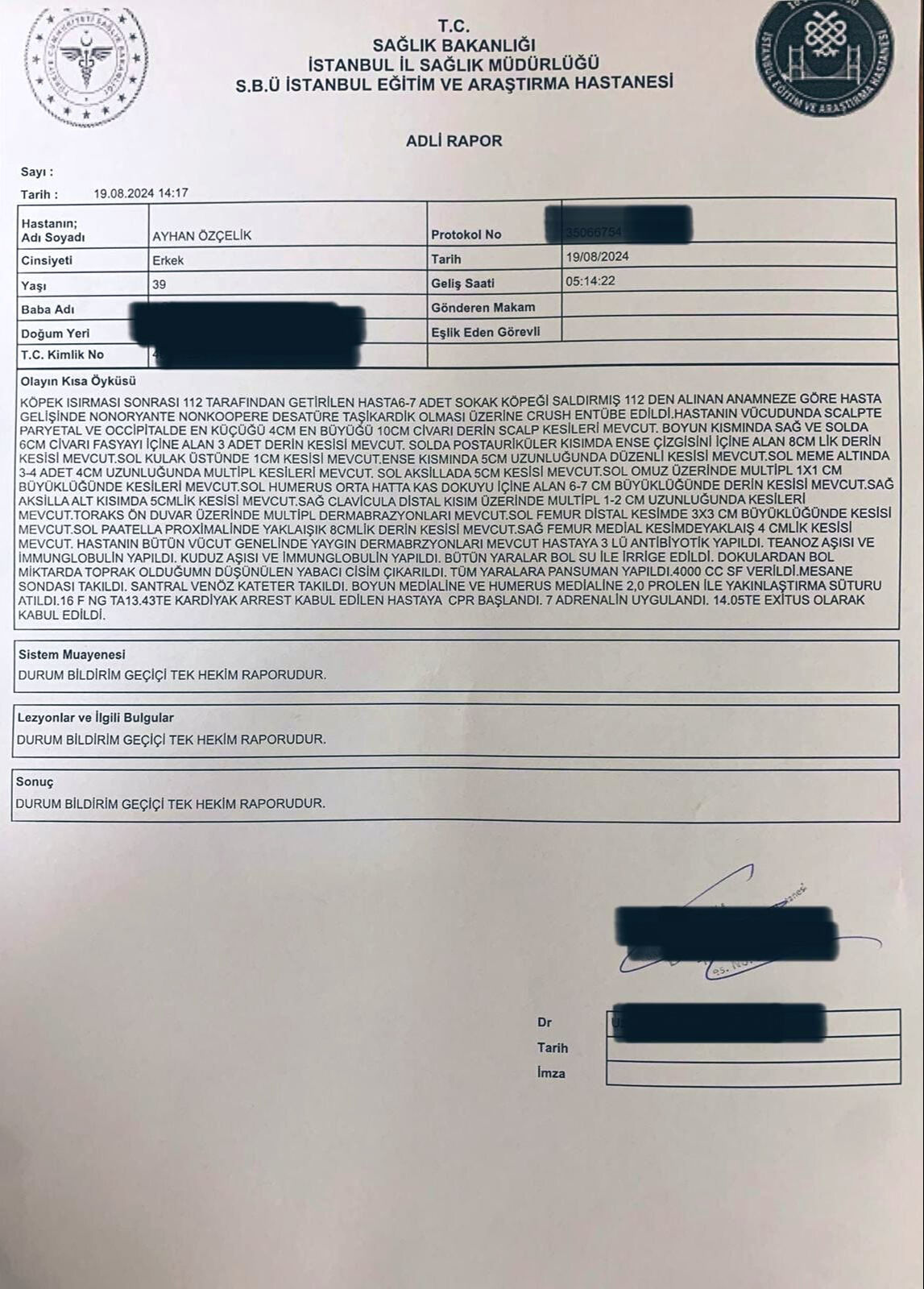 Fatih’te başıboş köpekler Ayhan Özçelik'i öldürmüştü! Hastane raporu vahşetin boyutunu ortaya çıkardı Fatih’te başıboş köpekler Ayhan Özçelik'i öldürmüştü! Hastane raporu ortaya çıktı - 1. Resim