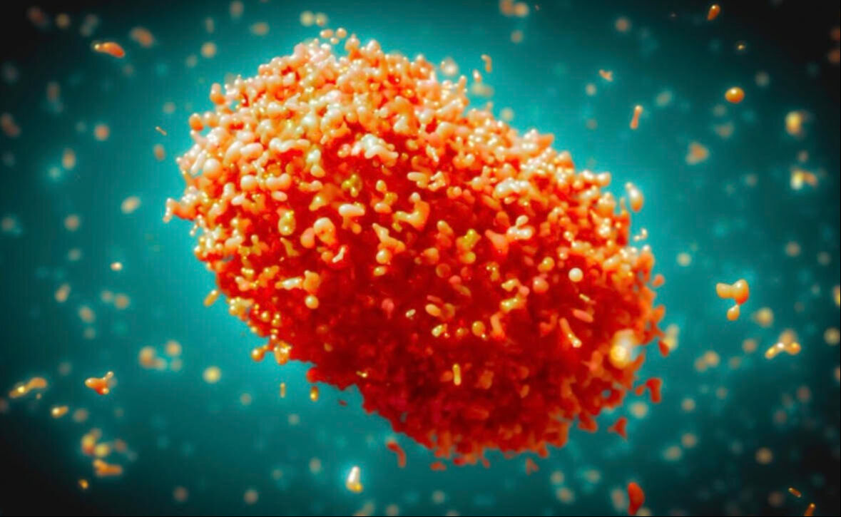 Türkiye'de 'Maymun Çiçeği' görüldü mü? Sağlık Bakanı Memişoğlu: Her türlü tedbiri aldık - 3. Resim