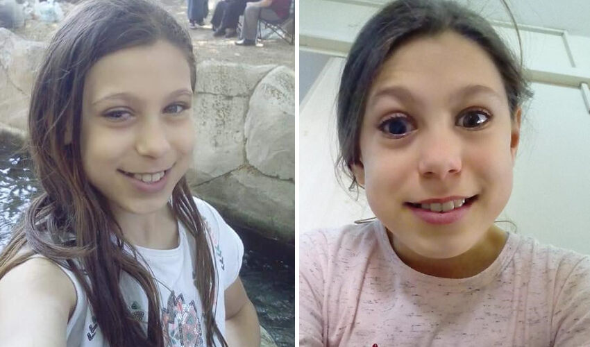 İzmir’de akıl almaz kaza: Market poşetini açmaya kalktı, hayatı kabusa döndü! - 2. Resim