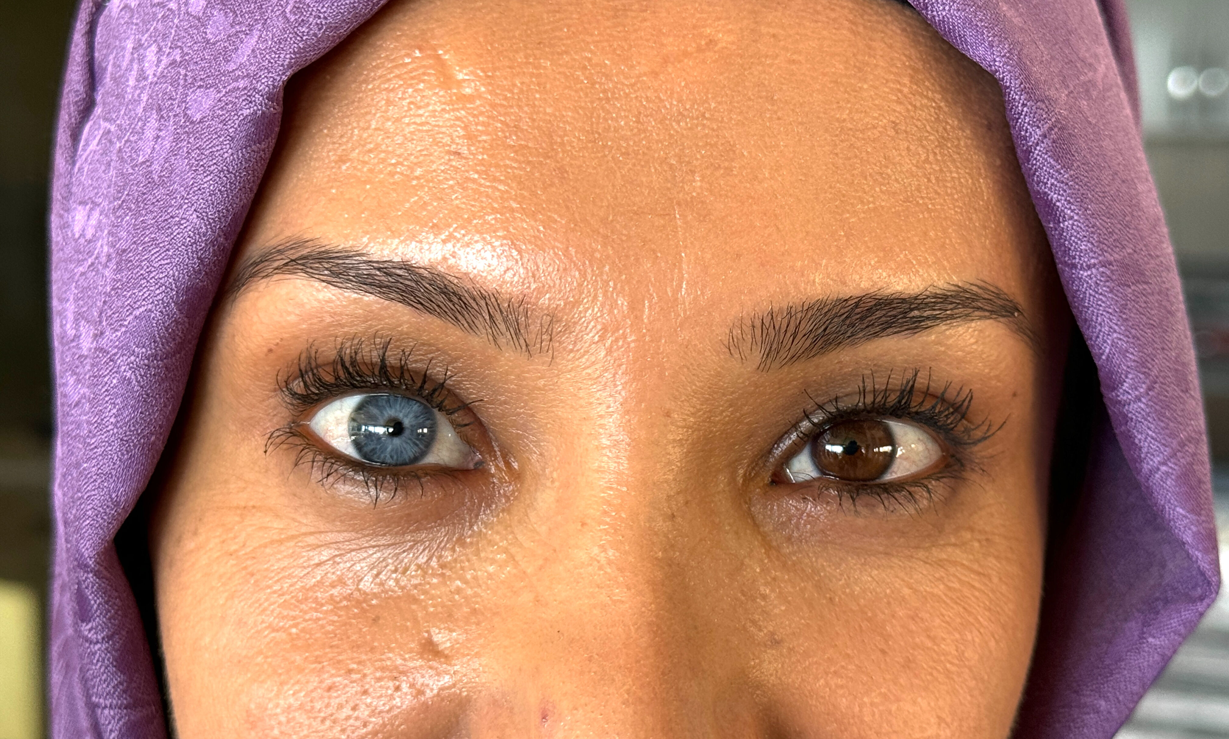 Kahramanmaraş'taki çevresini mavi ve kahverengi gözlerinin gerçek olduğuna inandırmaya çalışıyor - 2. Resim