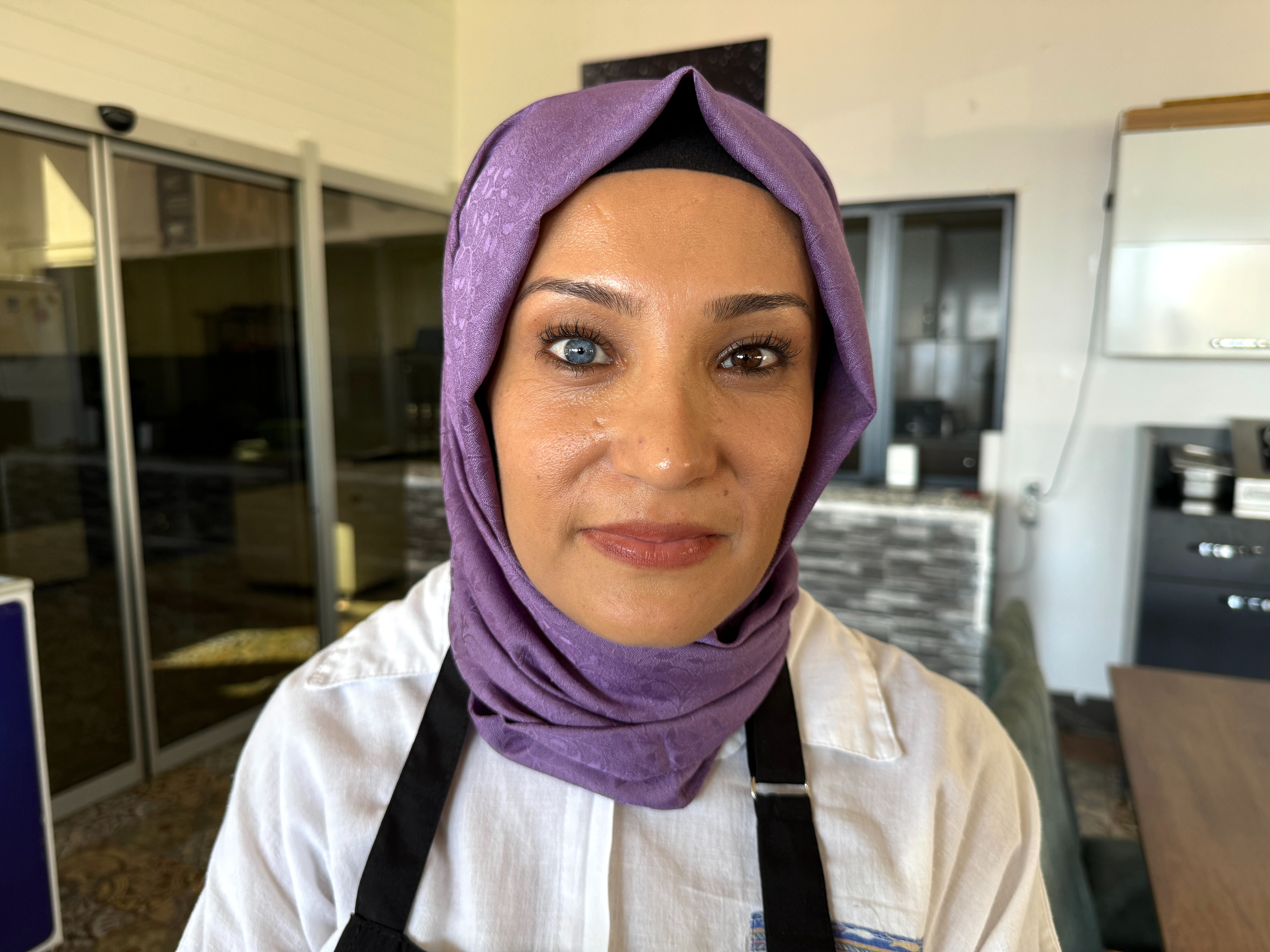 Mavi ve kahverengi gözlerinin gerçek olduğuna Kahramanmaraş'taki çevresine inandırmaya çalışıyor - 1. Resim