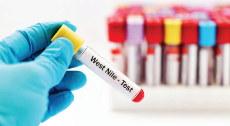 Batı Nil virüsünü göçmen kuşlar taşıyor Batı Nil virüsünü göçmen kuşlar taşıyor - 1. Resim