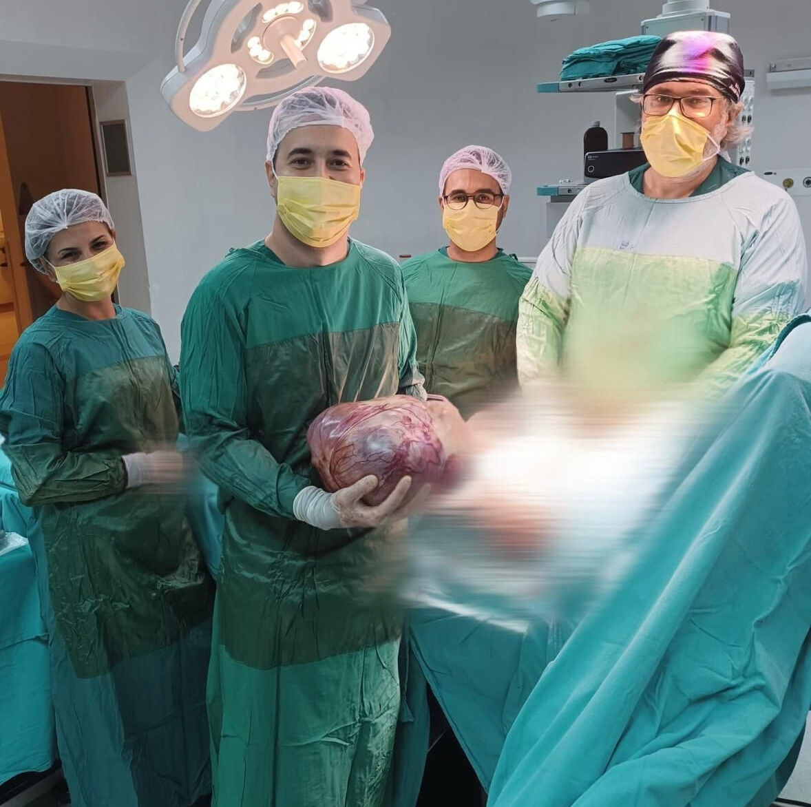 Ağrı, şişlik ve nefes darlığı şikayetiyle hastaneye gitti! Karnından çıkan doktorları bile şaşırttı - 2. Resim