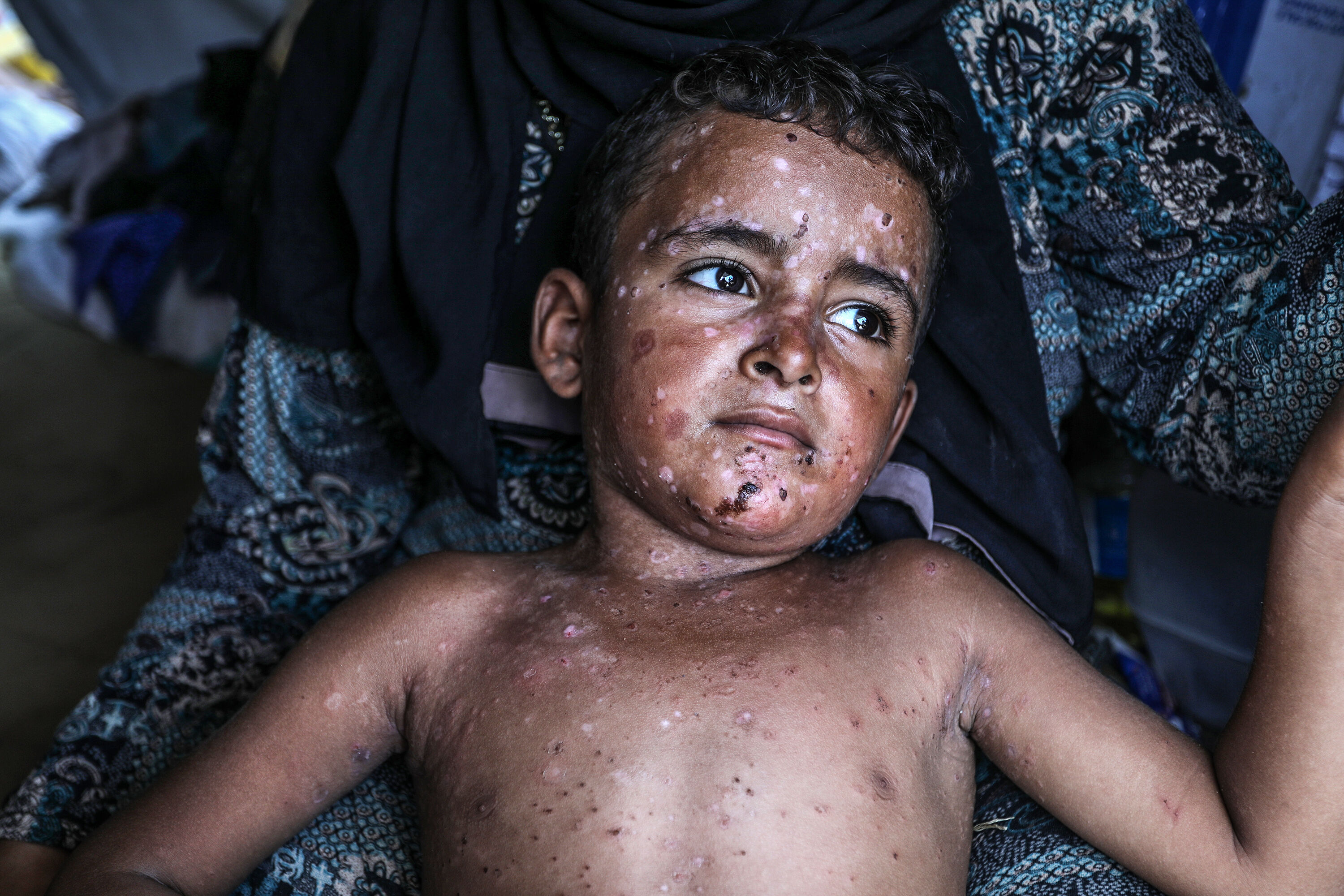 İsrail’in Gazze'de  gerçekleştirdiği soykırımda şu ana kadar 16 bin 589 çocuk öldü… Soykırımın toplam bilanço ise korkutucu - 4. Resim