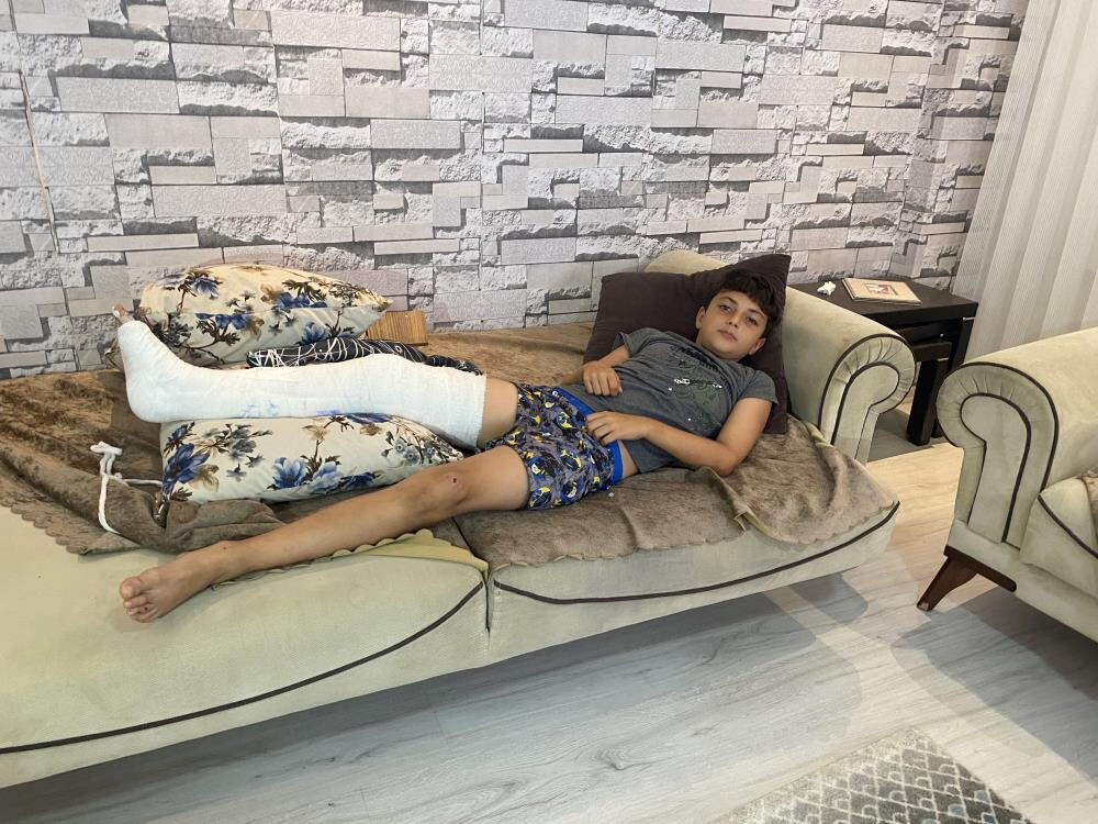 Futbolcu olmanın hayalini kuran Deniz Ilgar Bal, başıboş köpeklerin saldırısında ayağını kırdı Futbolcu olmanın hayalini kuran Deniz Ilgar Bal, başıboş köpeklerin saldırısında ayağını kırdı - 2. Resim