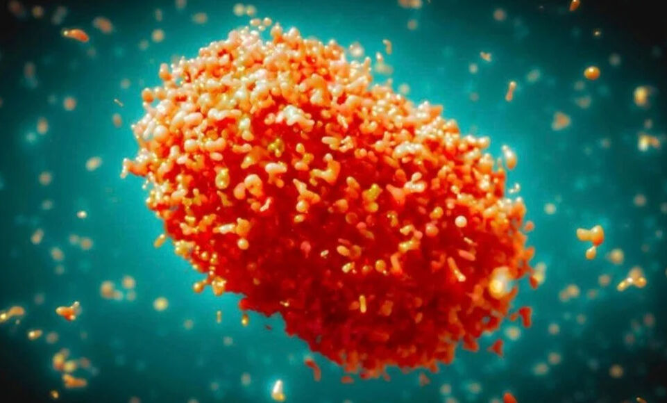 Maymun çiçeği virüsüyle ilgili korkutan açıklama! Ölen kişi sayısını duyurdular Maymun çiçeği virüsüyle ilgili korkutan açıklama! Ölen kişi sayısını duyurdular - 3. Resim