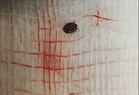 Bitlis'te kedi seven kızın gözüne kene kaçtı Bitlis'te kedi seven kızın gözüne kene kaçtı - 2. Resim