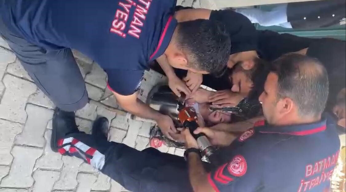 Miniğin oyunu kabusa döndü! 2 yaşındaki çocuk düdüklü tencerede sıkıştı Miniğin oyunu kabusa döndü! 2 yaşındaki çocuk düdüklü tencerede sıkıştı - 1. Resim