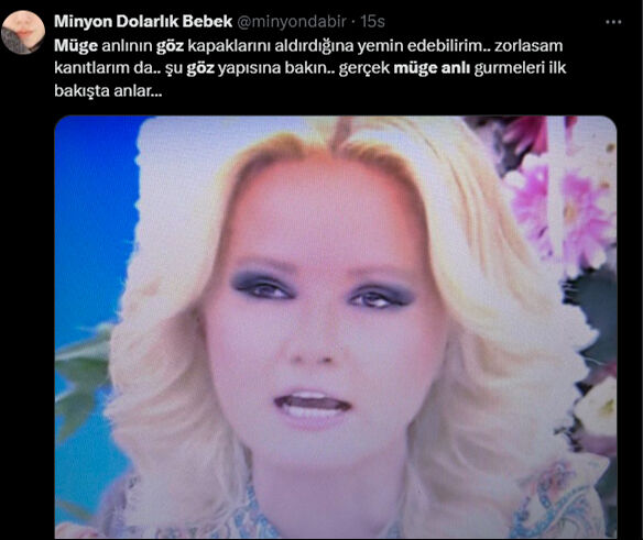 Ekranlara geri dönen Müge Anlı’nın yüzündeki değişim gözlerden kaçmadı, estetik yorumları peş peşe geldi - 4. Resim