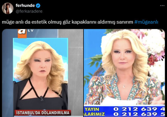 Ekranlara geri dönen Müge Anlı’nın yüzündeki değişim gözlerden kaçmadı, estetik yorumları peş peşe geldi - 3. Resim