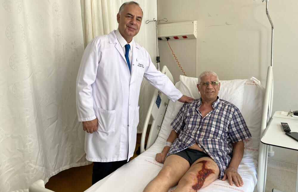 Bahçelievler'de tıkanan gideri açmak isterken vücudunun yüzde 40'ı yandı - 2. Resim