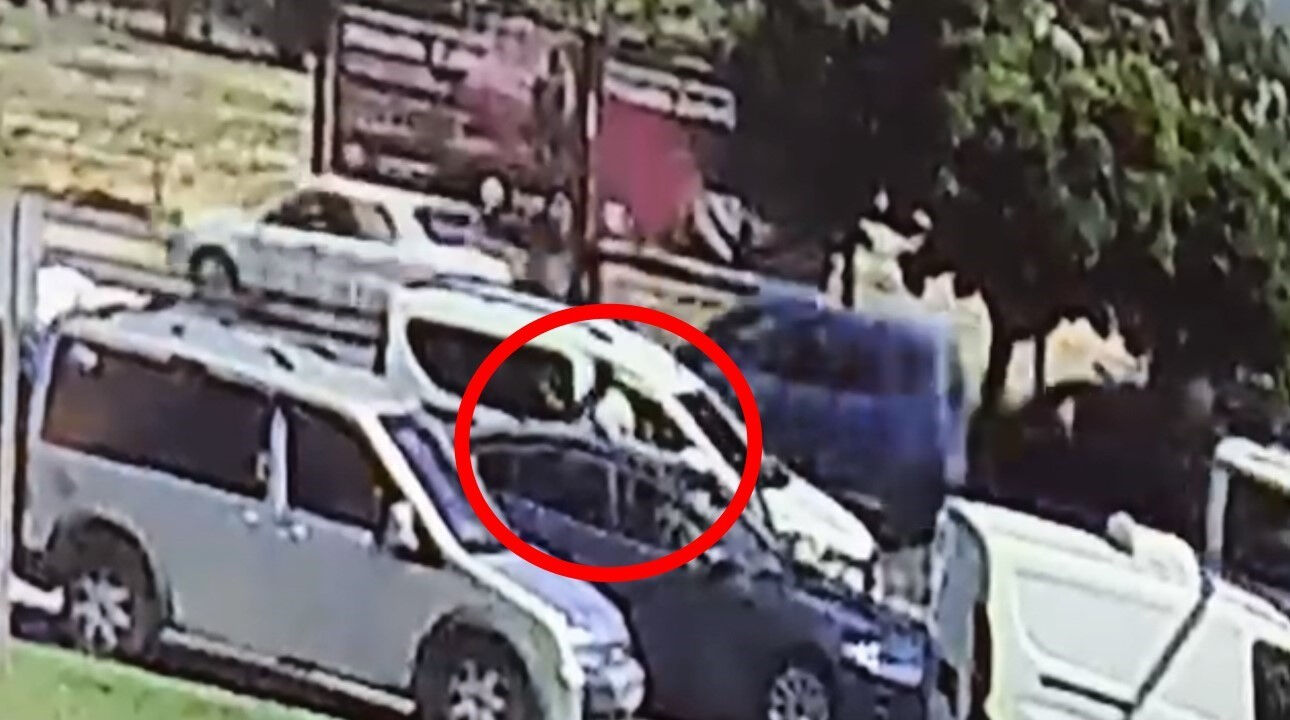 Bursa'daki nişanlı dehşetinde acı gelişme: Elif'in iki bacağı da kesildi... Bursa'daki nişanlı dehşetinde acı gelişme: Elif'in iki bacağı da kesildi... - 1. Resim