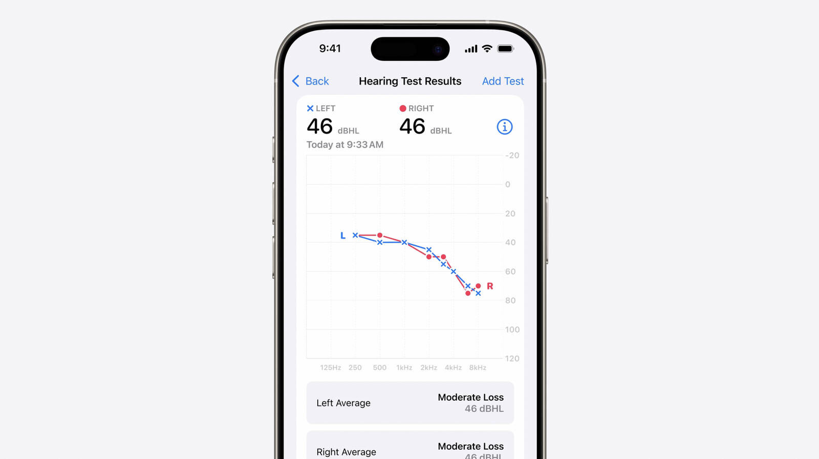 Yeni iPhone 16 kaç TL olacak? Dünyanın gözü Apple 