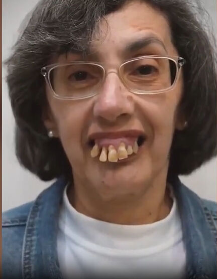 59 yıldır sorunlar yaşıyordu! Bambaşka birine dönüştü: Yeni hali şoke etti 59 yıldır sorunlar yaşıyordu! Bambaşka birine dönüştü: Yeni hali şoke etti - 2. Resim