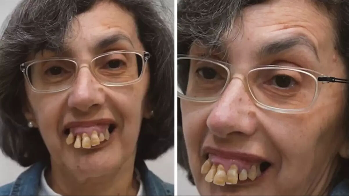 59 yıldır sorunlar yaşıyordu! Bambaşka birine dönüştü: Yeni hali şoke etti 59 yıldır sorunlar yaşıyordu! Bambaşka birine dönüştü: Yeni hali şoke etti - 1. Resim