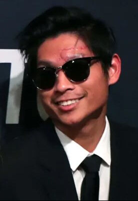 Angelına Jolıe’nin evlatlığı yüzünde derin yara izleriyle ortaya çıktı! Angelına Jolıe’nin evlatlığı yüzünde derin yara izleriyle ortaya çıktı! - 2. Resim