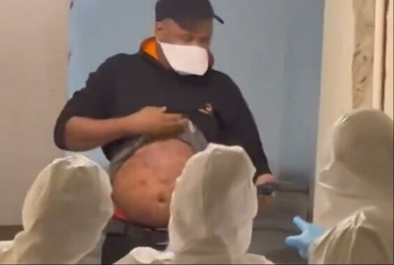 İstanbul'da maymun çiçeği alarmı! Göbeğini açıp gösterdi, bakanlık test sonucunu paylaştı - 1. Resim