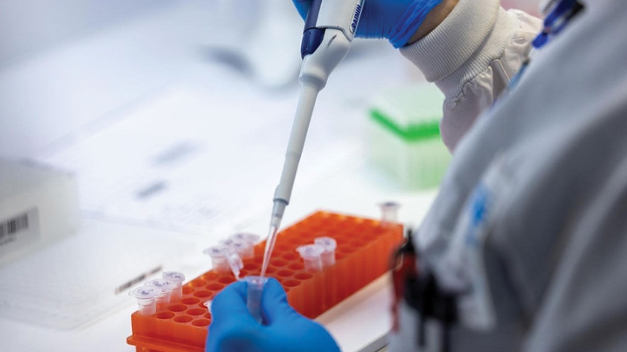 Maymun virüsüne karşı ilk aşı için onay çıktı! DSÖ aşının ön yeterlilik aldığını duyurdu - 4. Resim