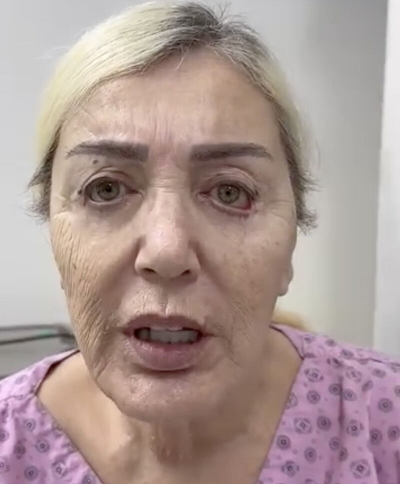Estetik nedeniyle yüzü deforme olmuştu! Seda Sayan’ın ablası Nursel Sayan’ın son hali ortaya çıktı - 1. Resim
