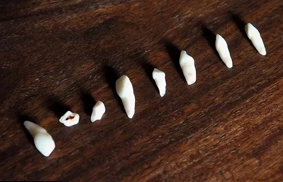 Ülkelerde en sık görülen rüyalar neler? Türkiye şaşırttı - 2. Resim