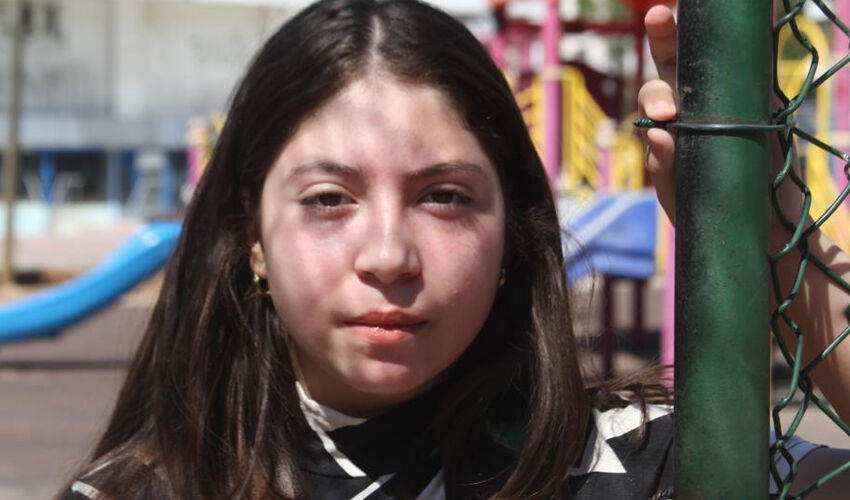 Basketbol sahasında dehşete düşüren olay! 24 dikişle hastaneden ayrıldı - 1. Resim