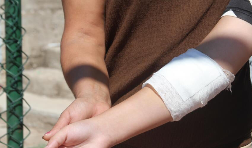 Basketbol sahasında dehşete düşüren olay! 24 dikişle hastaneden ayrıldı - 5. Resim